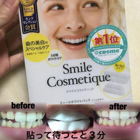 日本平價好用美白牙貼 用一次3分鐘見效！牙齒由黃變白